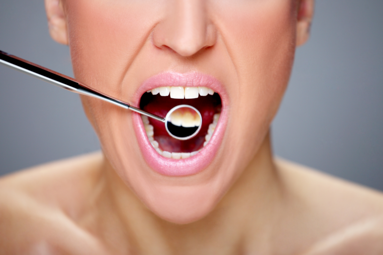 Oral Microbiome